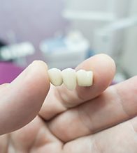 Example of dental bridge in Blaine