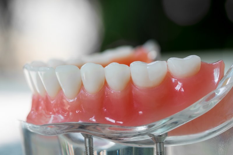 a set of new dentures on a glass surface